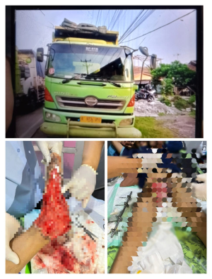 Tragedi By Pass Panjang: Benny Terlindas Truk, Keluarga Desak Keadilan